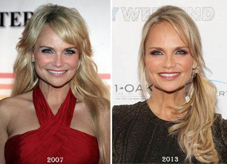 Kristin Chenoweth before and after picture where she claimed to be 88lbs.